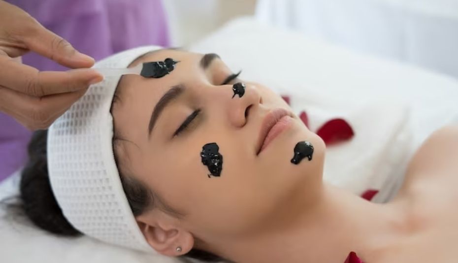 Antalya Konyaltı Carbon Peeling