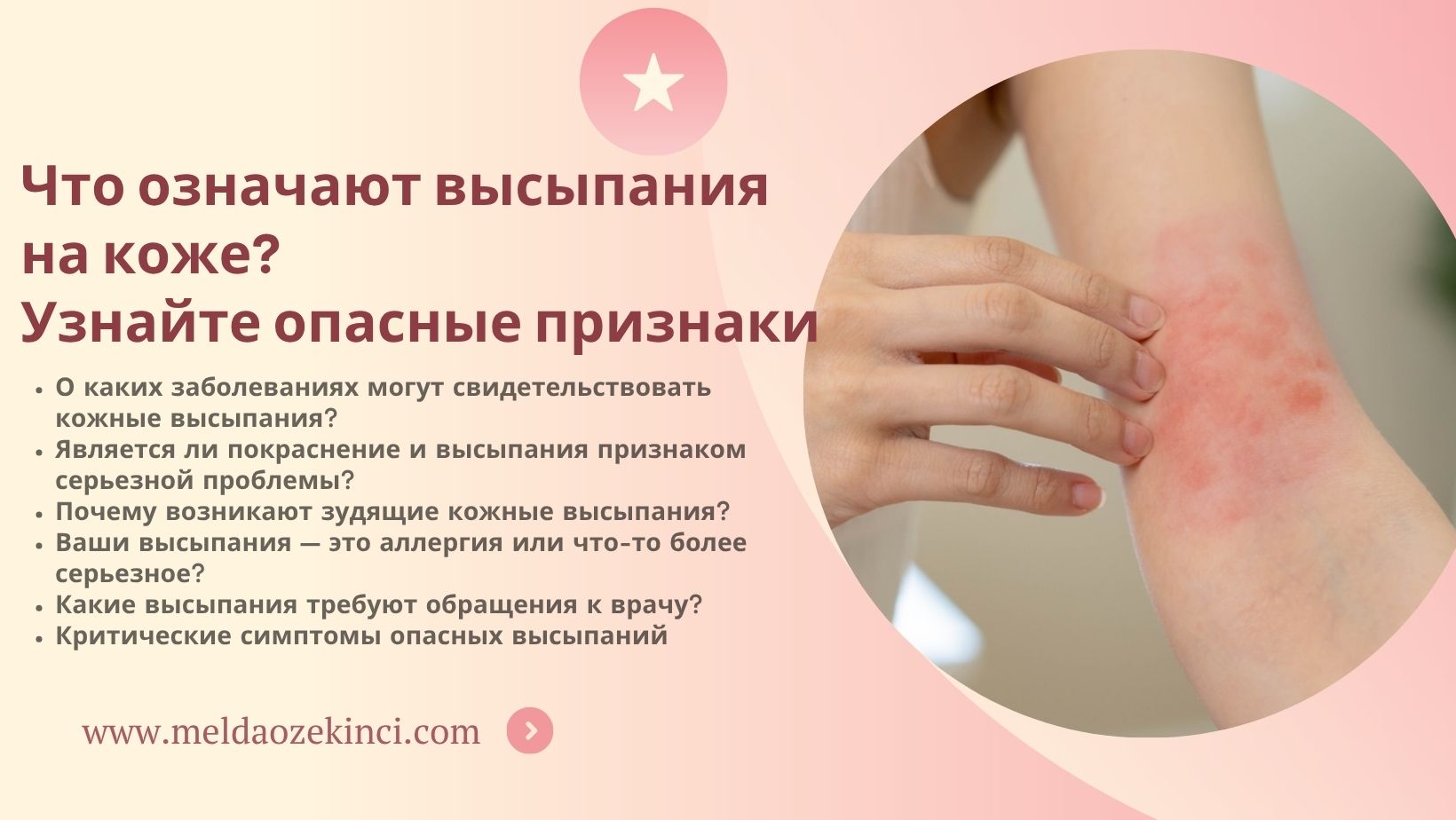 Что означают высыпания на коже? Узнайте опасные признаки 