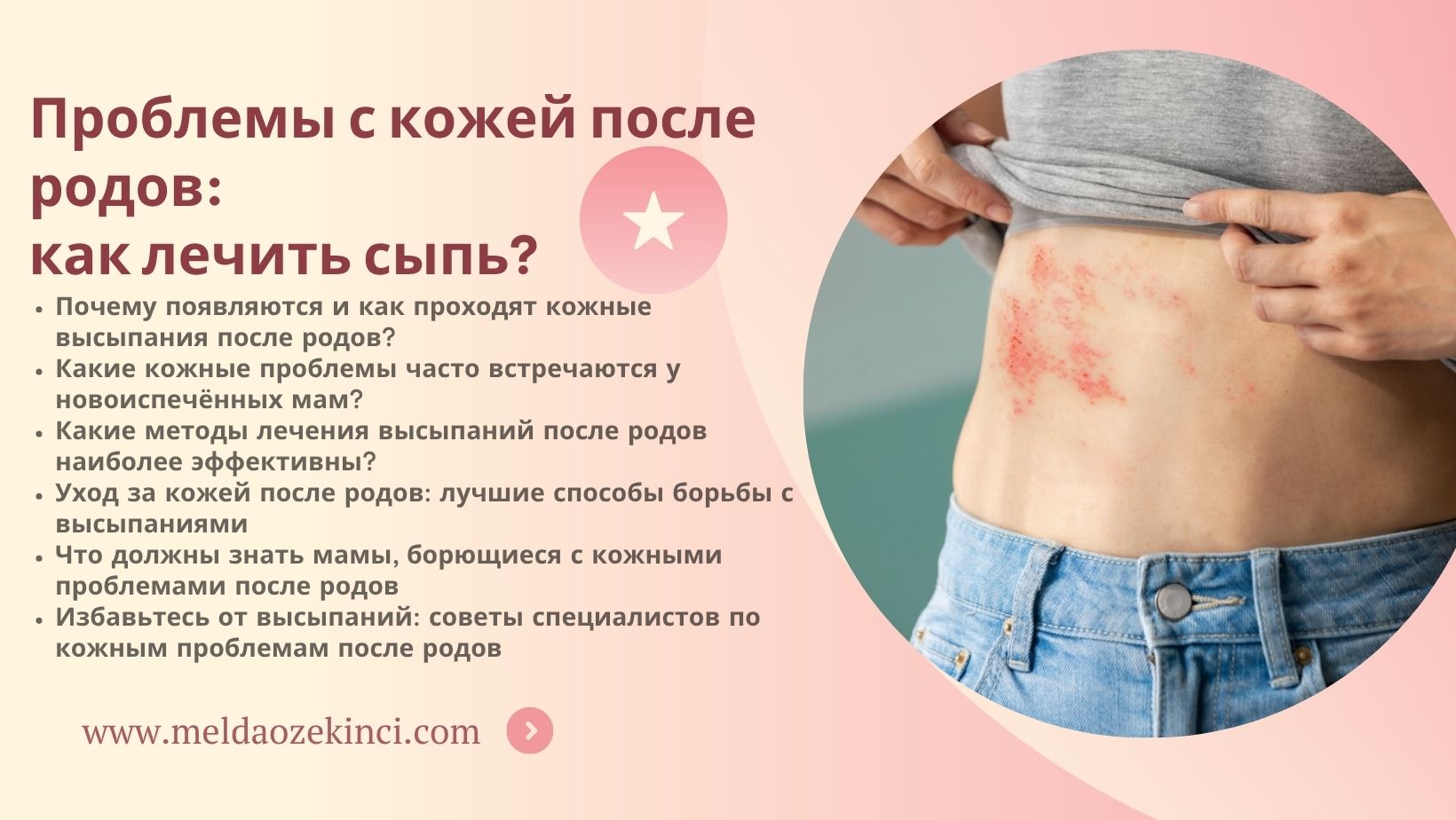 Проблемы с кожей после родов: как лечить сыпь? 
