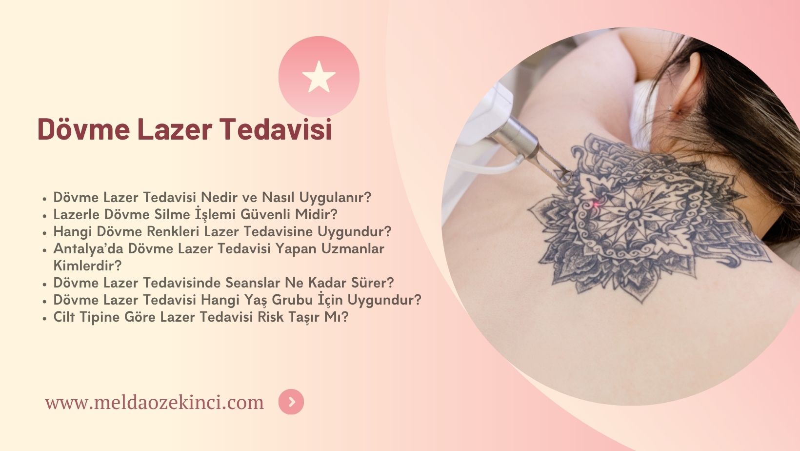 Dövme Lazer Tedavisi