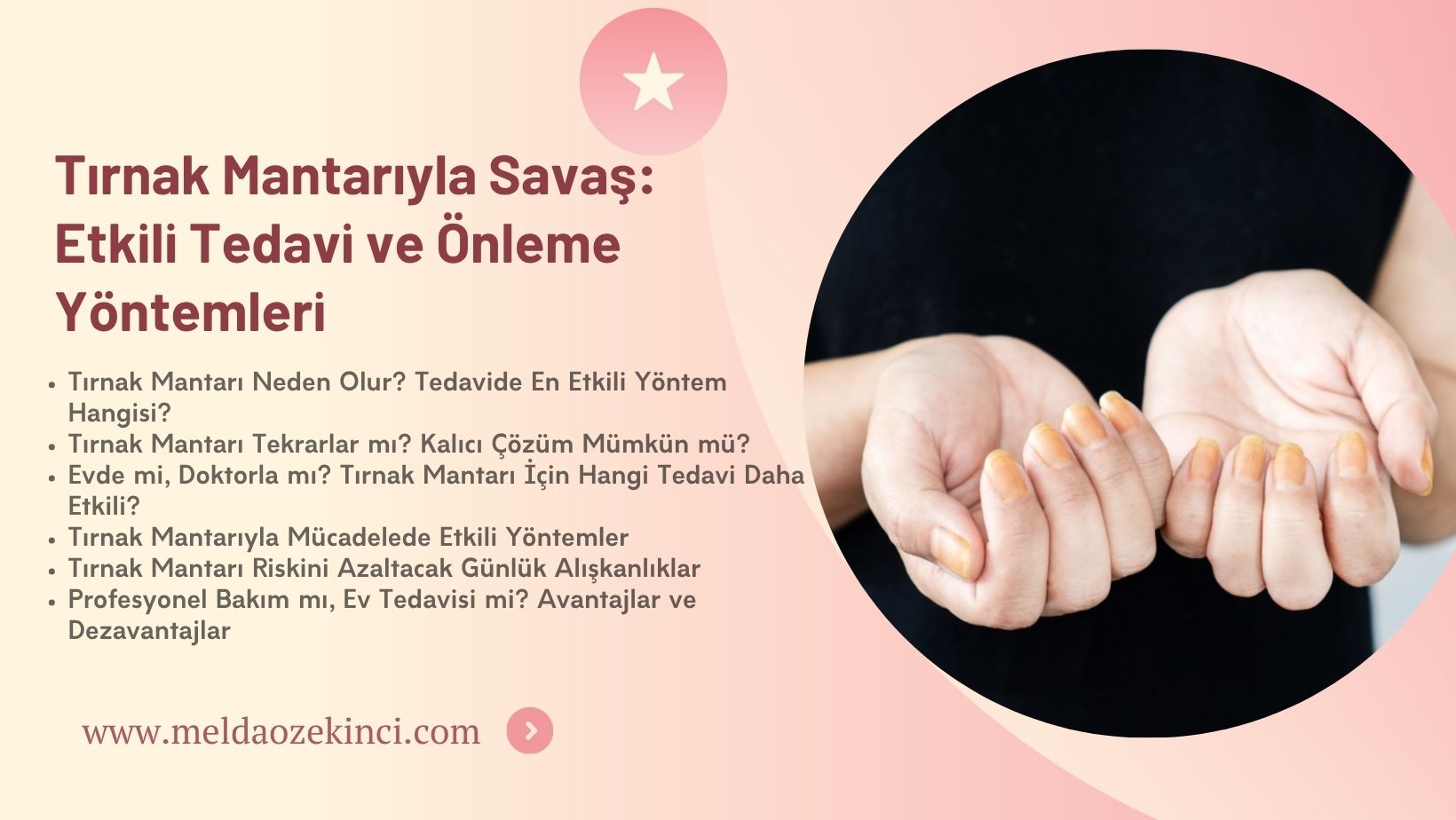 Tırnak Mantarıyla Savaş: Etkili Tedavi ve Önleme Yöntemleri