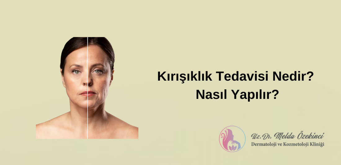 Kırışıklık Tedavisi