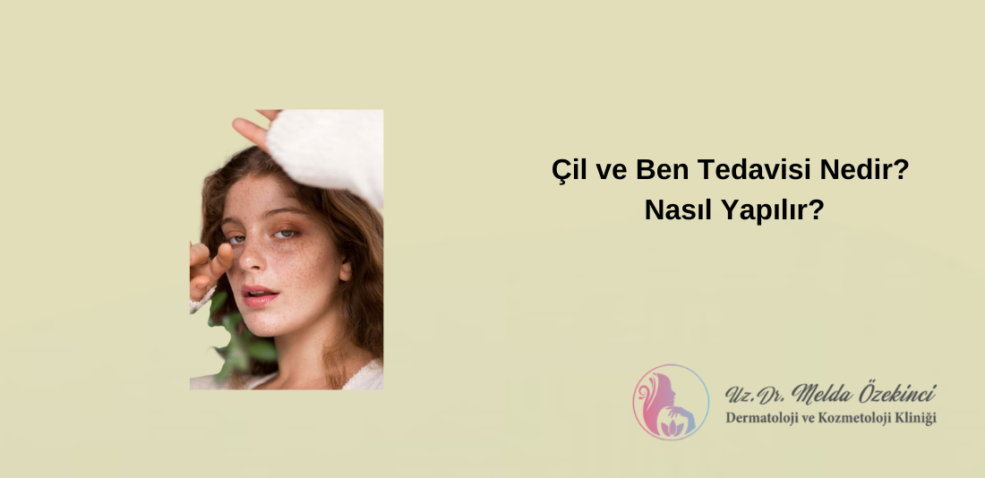 Çil ve Ben Tedavisi Çil ve Ben Tedavisi