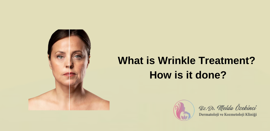 Wrinkle treatment