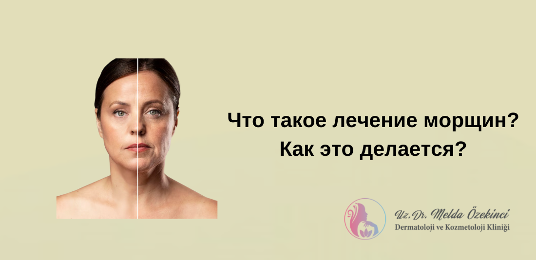 лечение морщин