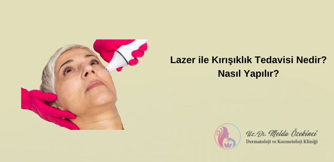 Lazerle Kırışıklık Tedavisi Lazerle Kırışıklık Tedavisi