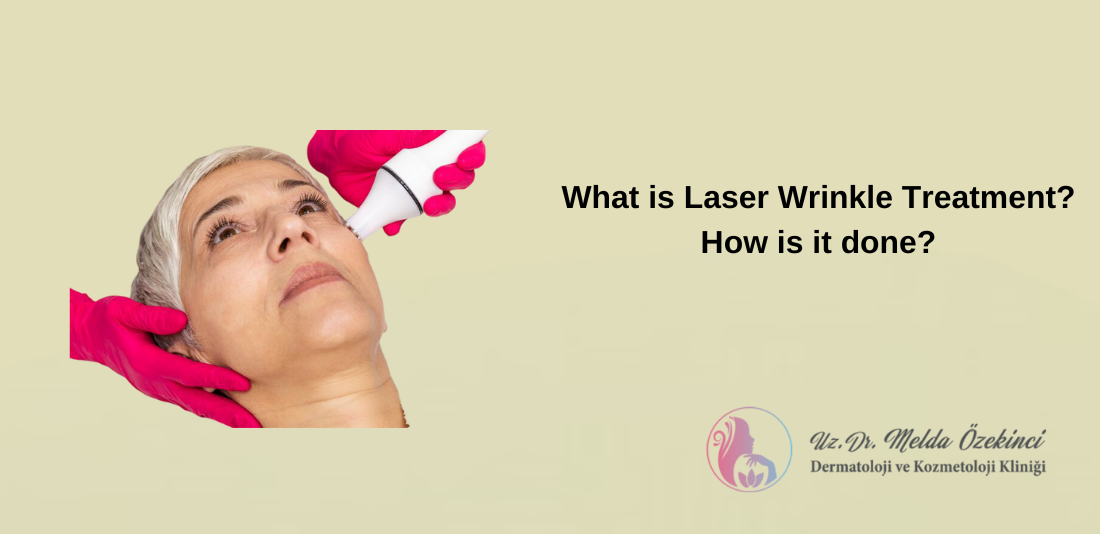 Laser Wrinkle Treatment Laser Wrinkle Treatment