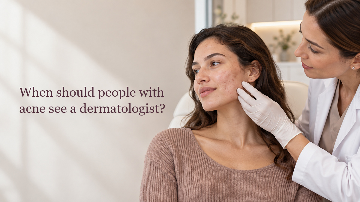 When should people with acne see a dermatologist?