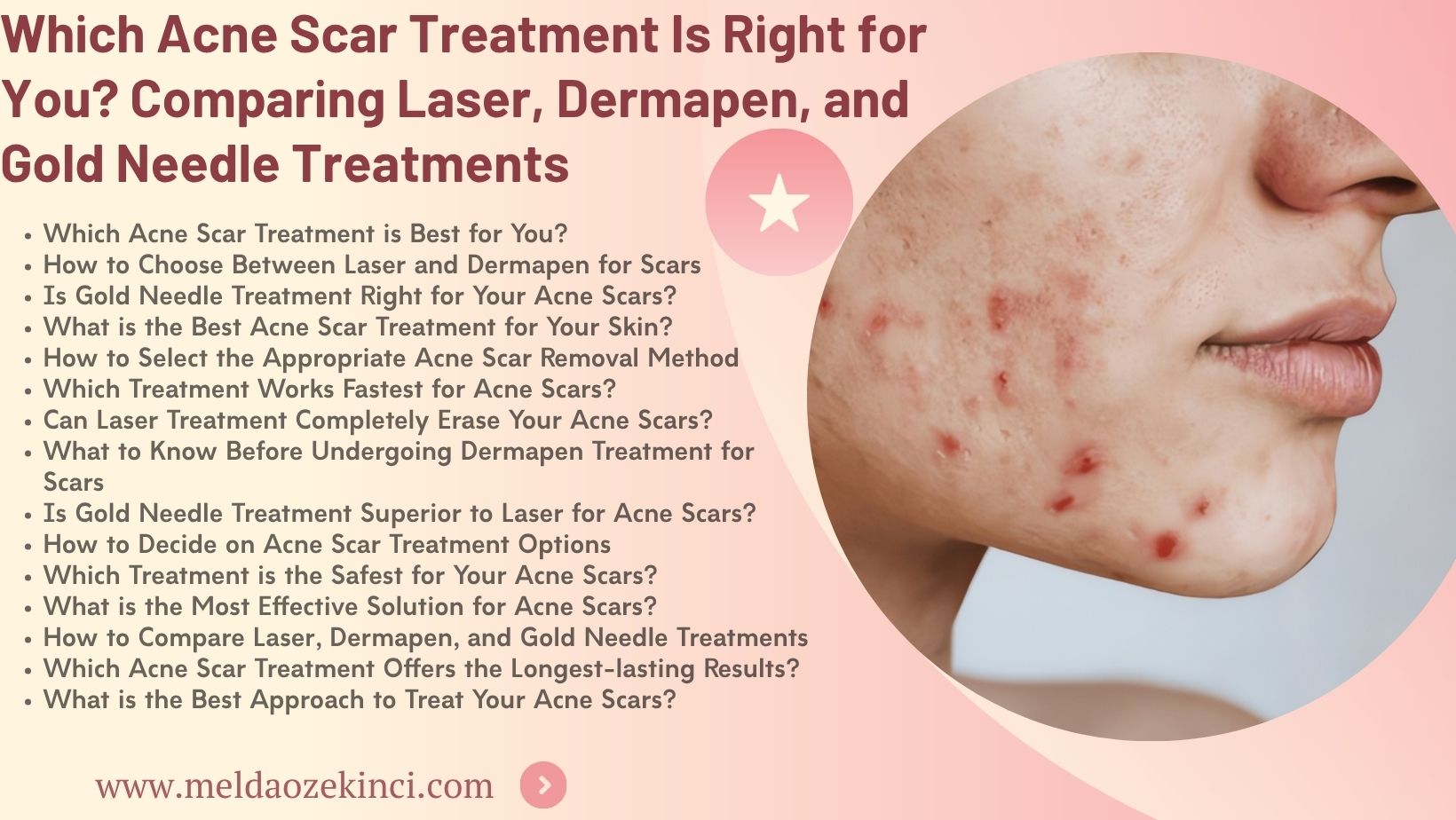 Which Acne Scar Treatment Is Right for You? A Comparison of Laser, Dermapen, and Gold Needle Treatments