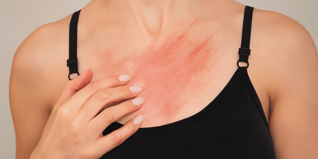 What Causes a Rash?
