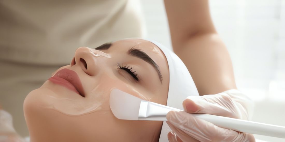 What is Chemical Peeling?