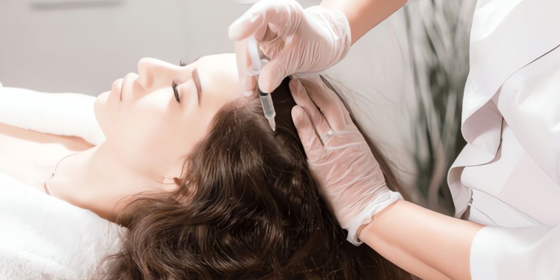 How Can Hair Loss Be Reduced with Hair Mesotherapy?