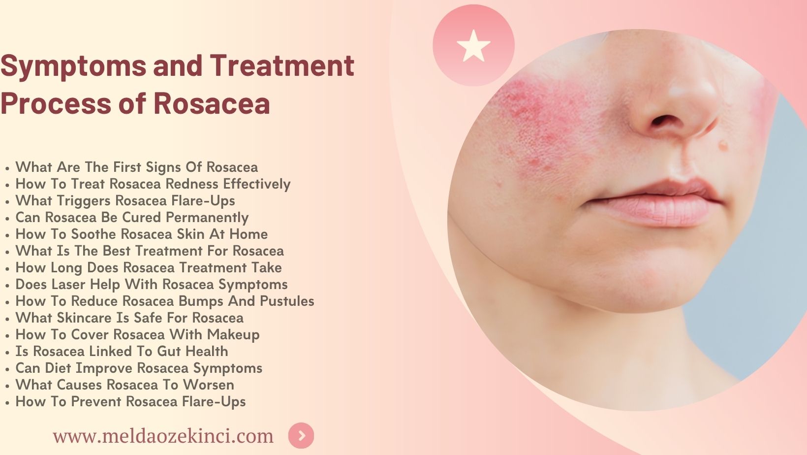Symptoms of Rosacea and the Treatment Process 