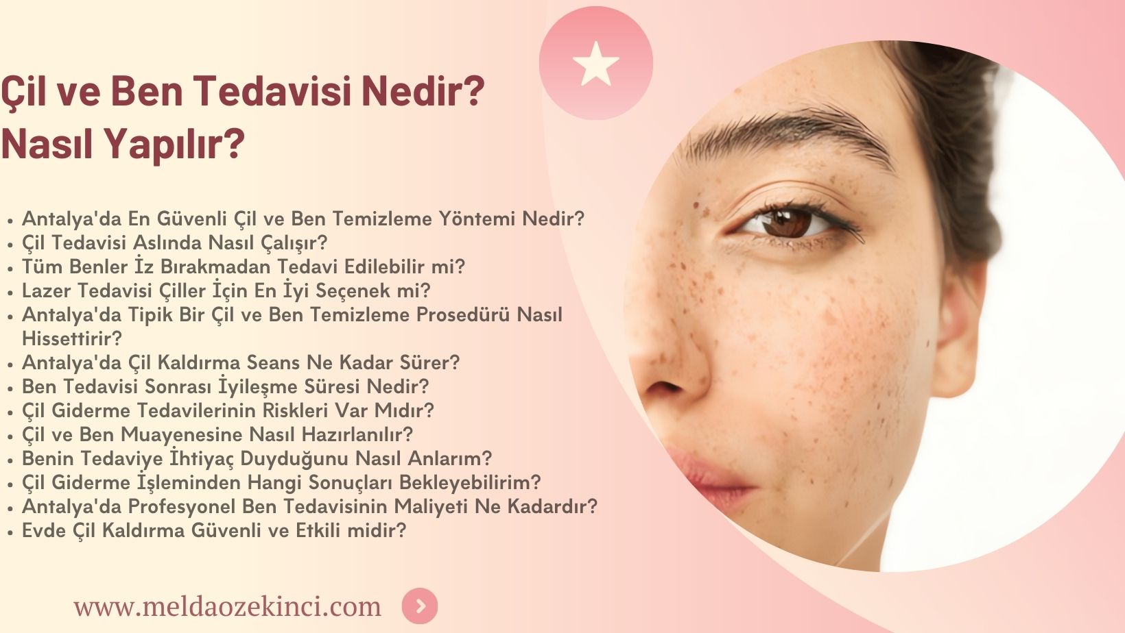Çil ve Ben Tedavisi Nedir? Nasıl Yapılır?