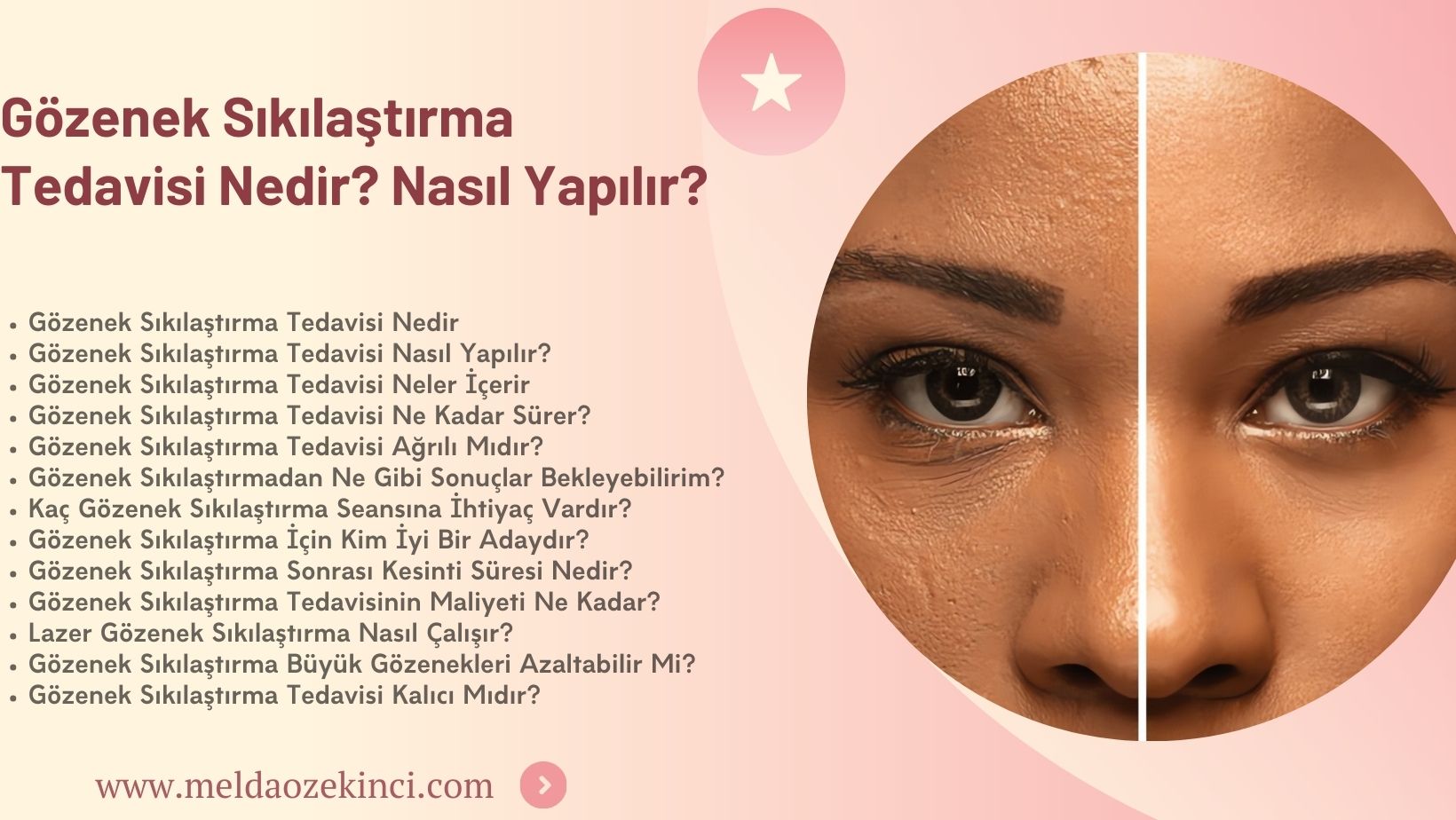 Gözenek Sıkılaştırma Tedavisi Nedir? Nasıl Gerçekleştirilir?