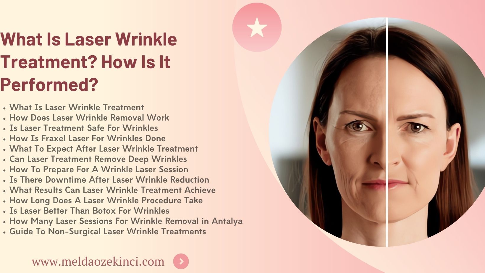 What Is Laser Wrinkle Treatment? How Is It Done?