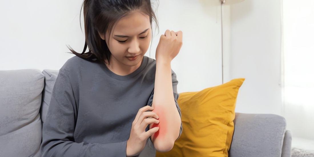 Как проводится дерматологический тест на аллергию?