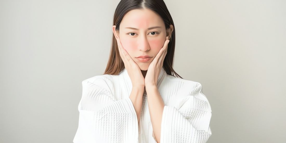 Как лечить розацеа (болезнь роз)?