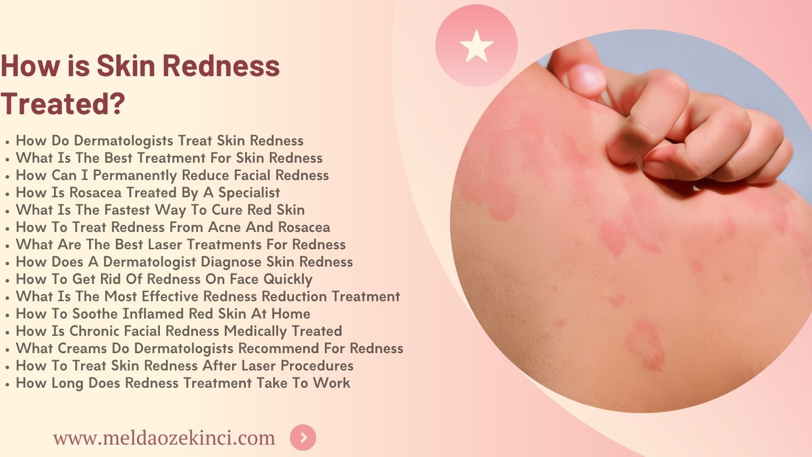 Как лечить покраснение кожи?