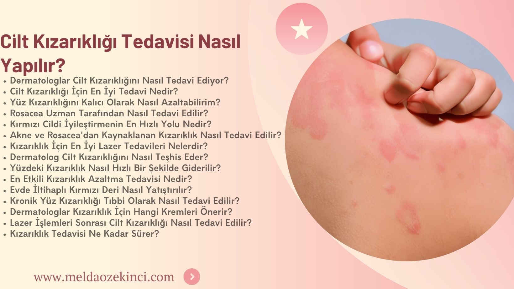 Cilt Kızarıklığı Nasıl Tedavi Edilir? 