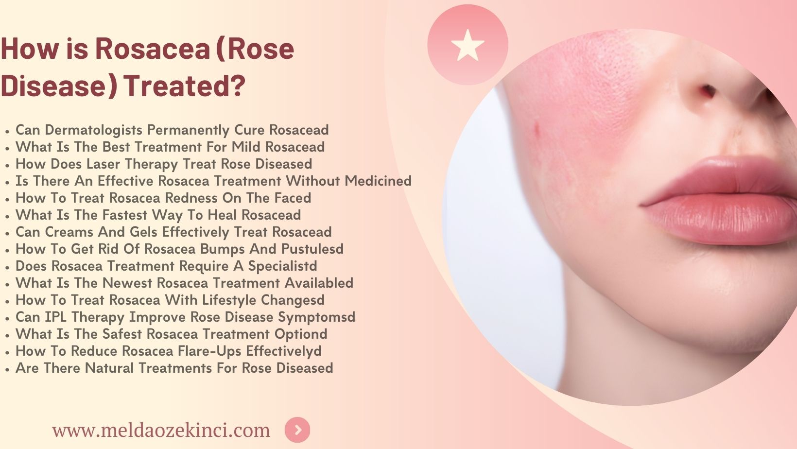 Как лечить розацеа (болезнь роз)?