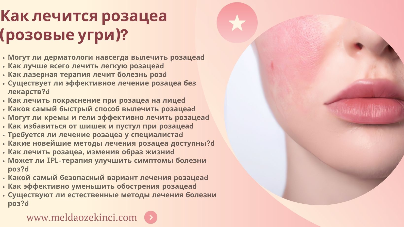How is Rosacea (Rose Disease) Treated?