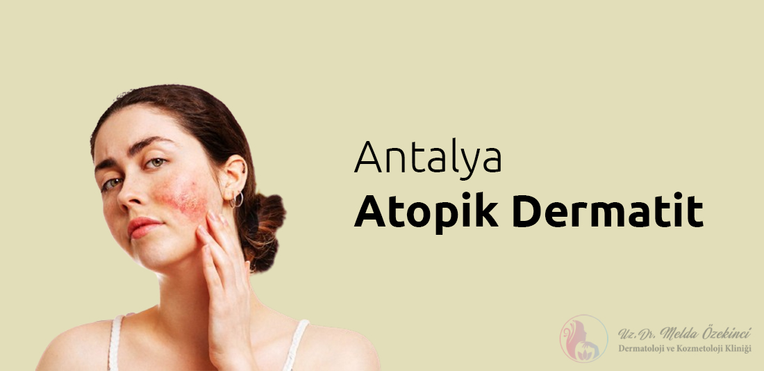 Antalya Atopik Dermatit: Hassas Cildin İyileşme Rehberi