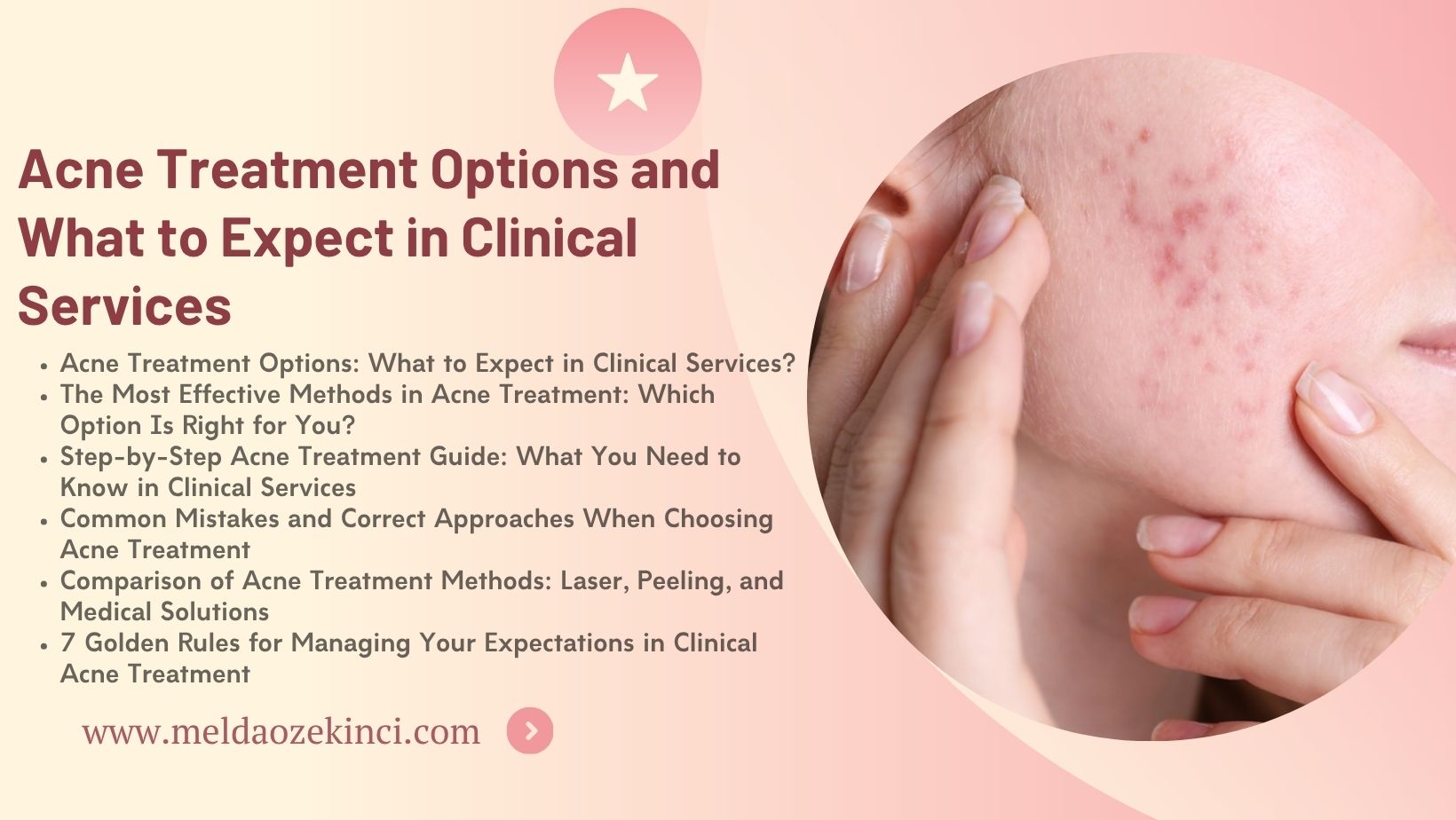 Acne Treatment Options and What to Expect in Clinical Services 