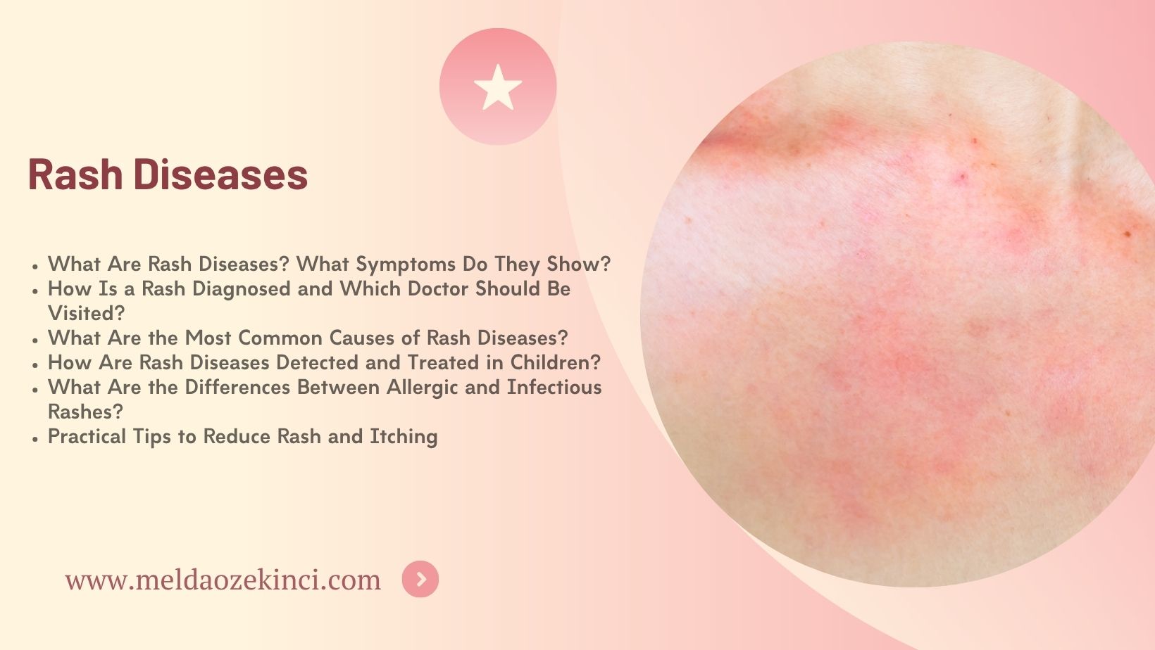 Rash Diseases