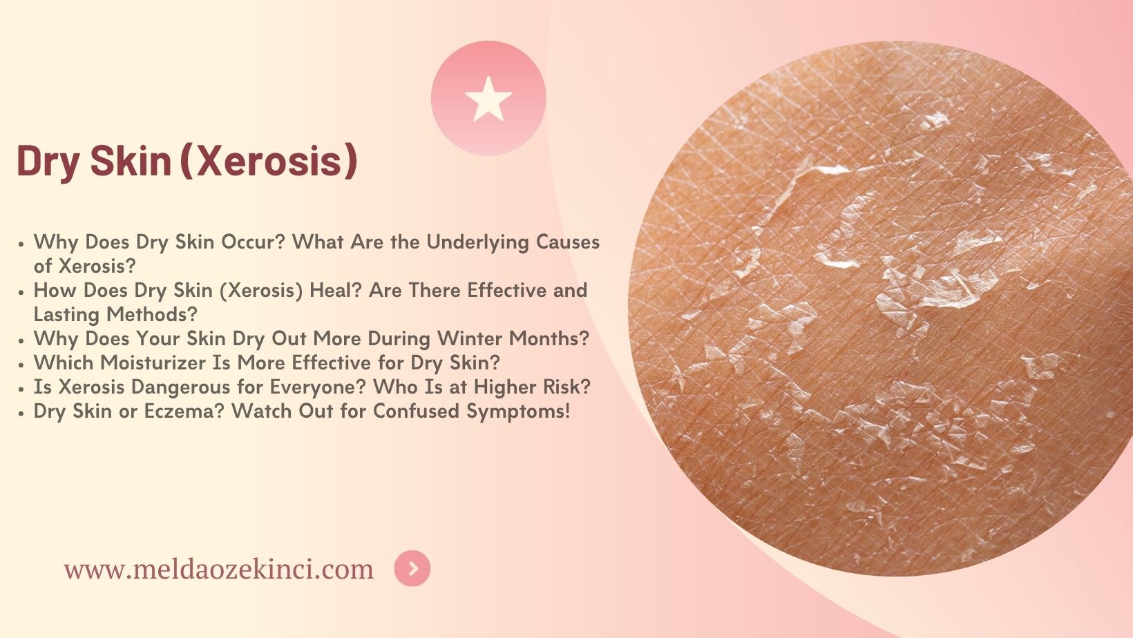 Dry Skin (Xerosis)