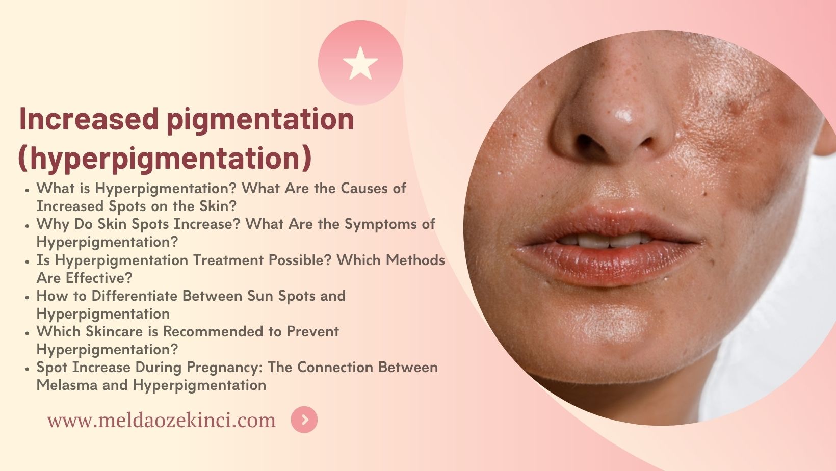 Increased pigmentation (hyperpigmentation)