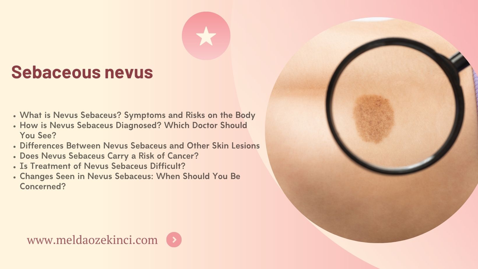 Sebaceous nevus