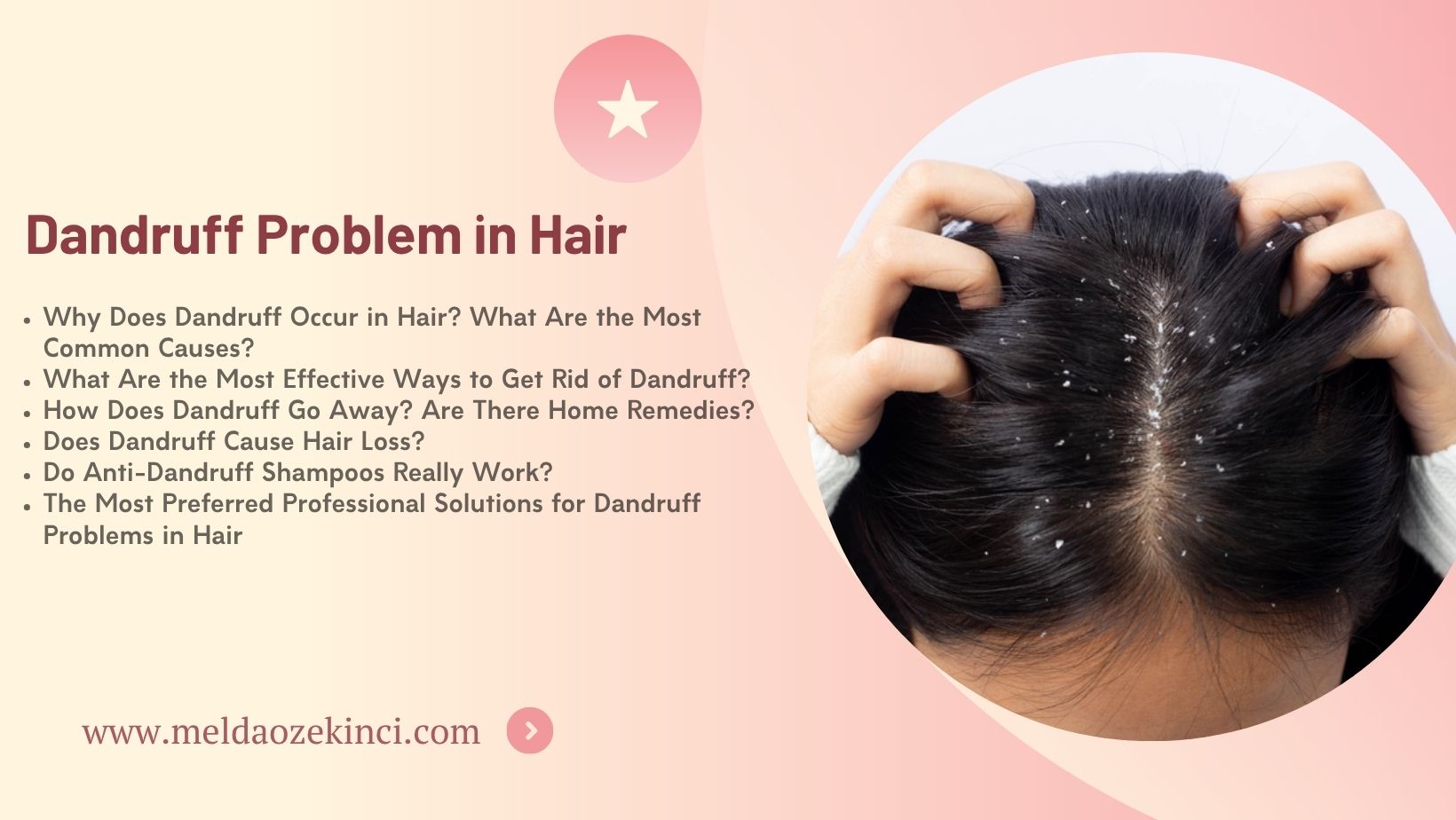 Dandruff Problem in Hair