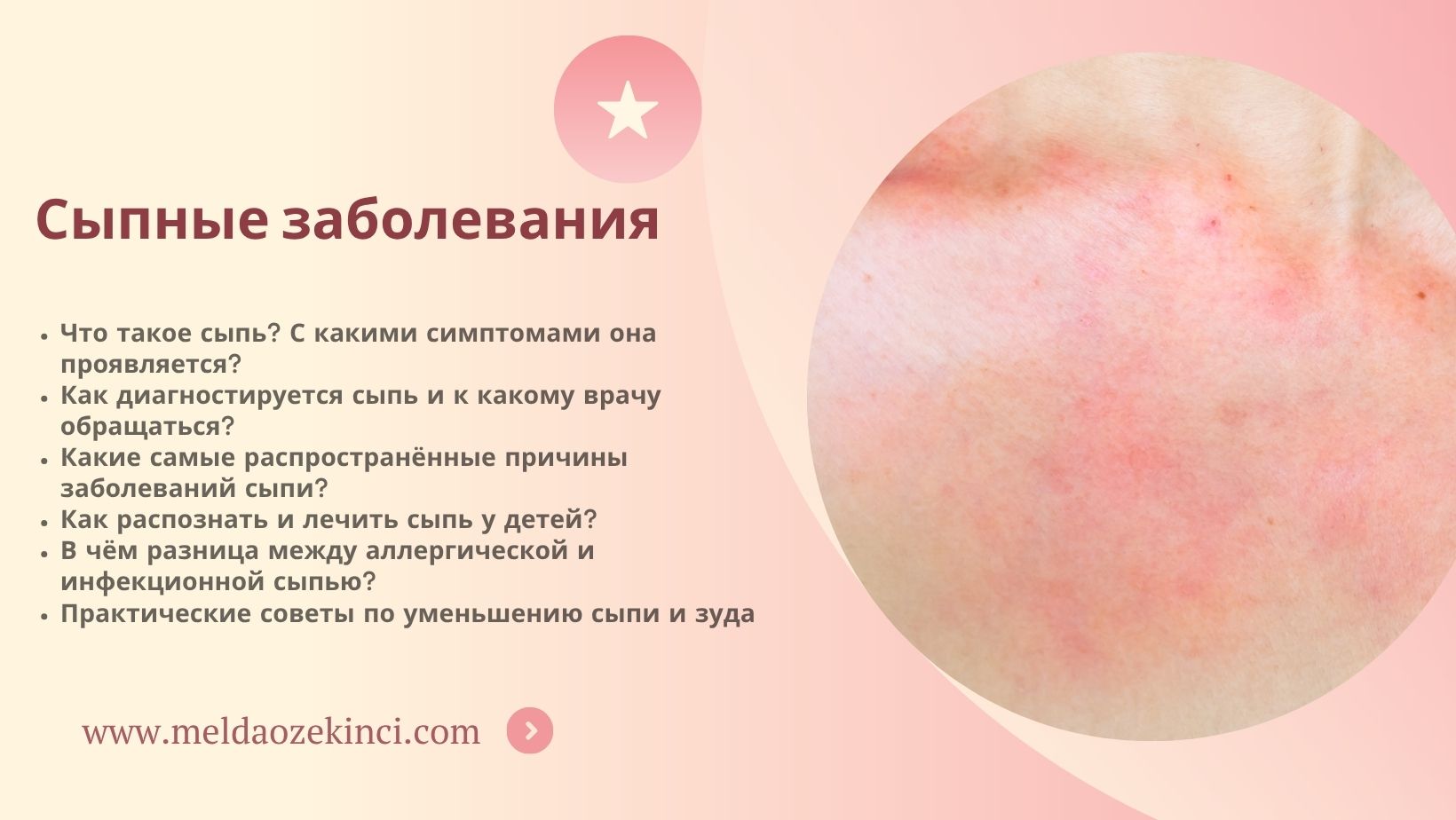 Сыпные заболевания