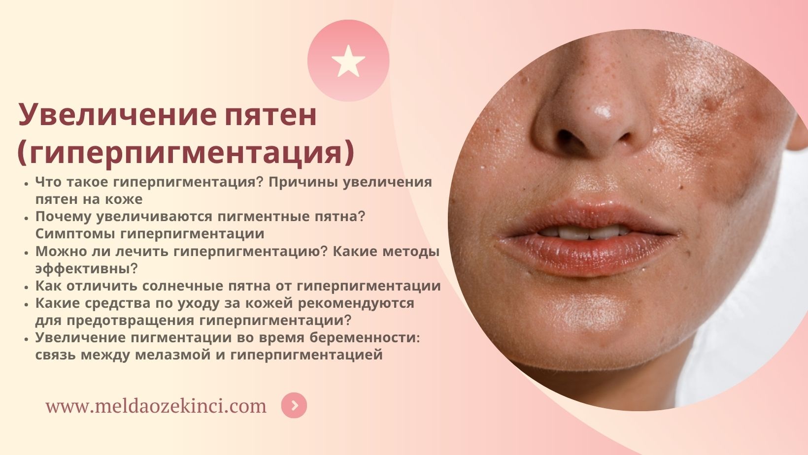 Увеличение пятен (гиперпигментация)