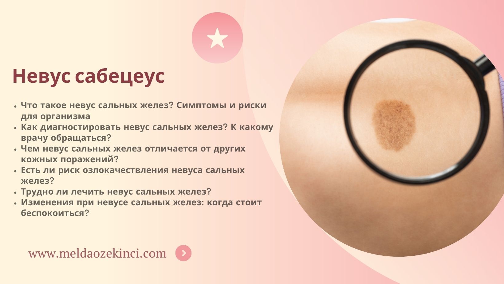 Невус сабецеус