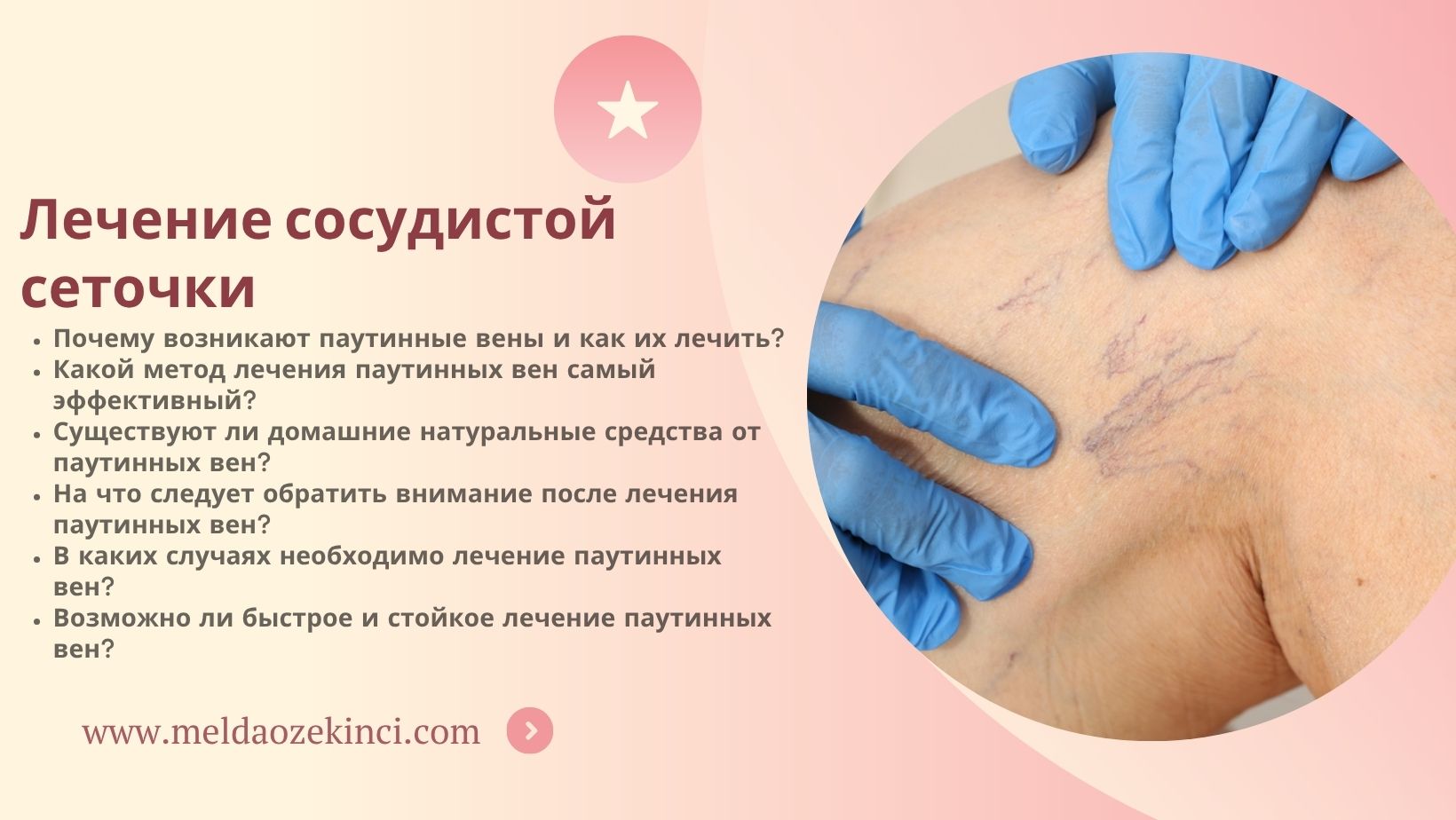 Лечение сосудистой сеточки