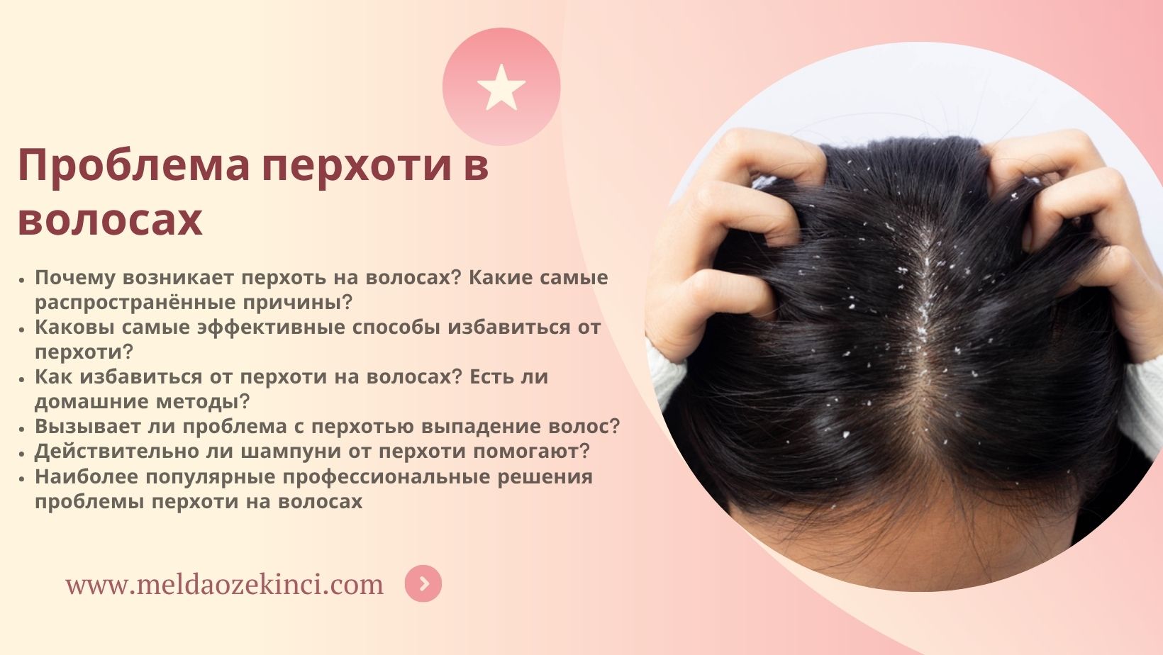 Проблема перхоти в волосах