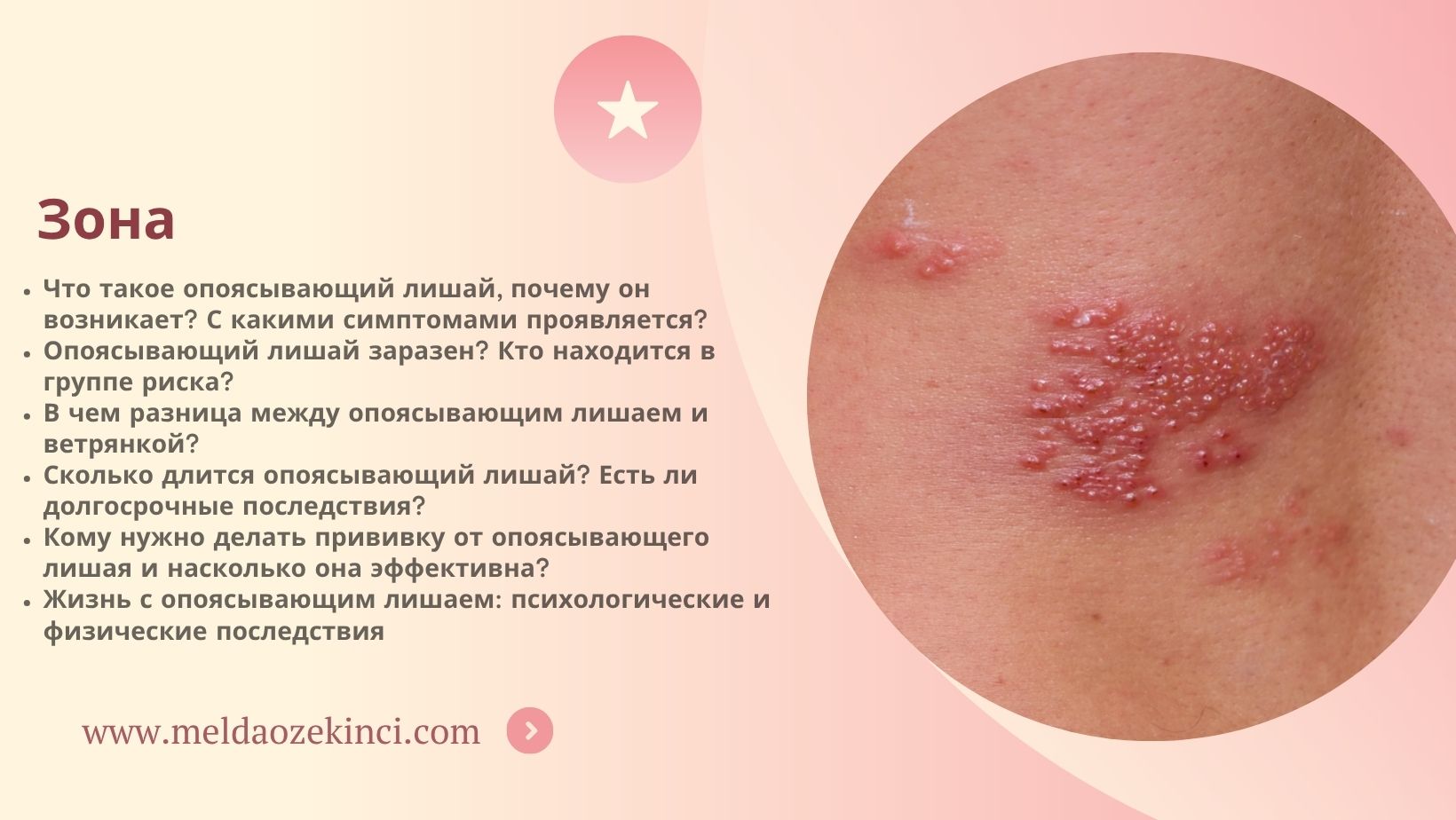Зона