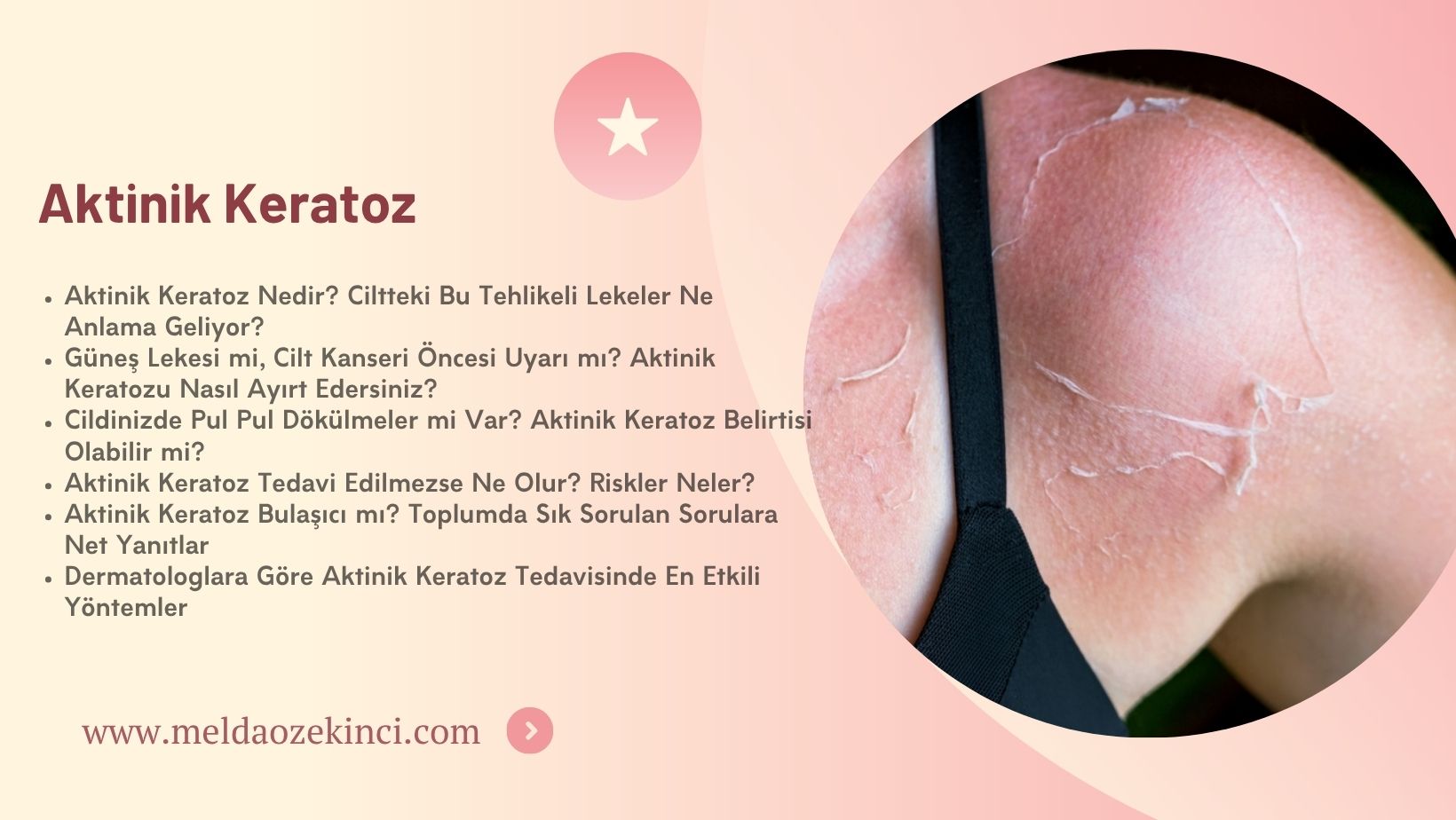 Aktinik Keratoz