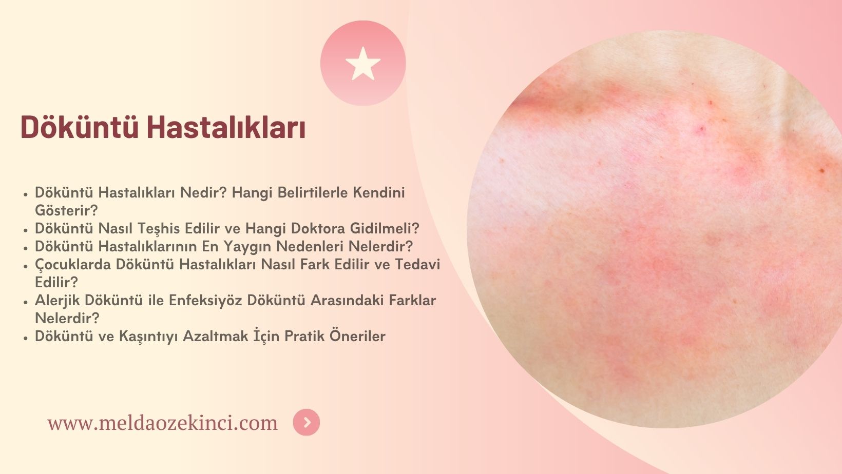 Döküntü Hastalıkları
