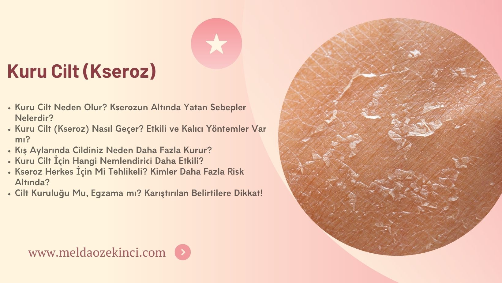 Dry Skin (Xerosis)