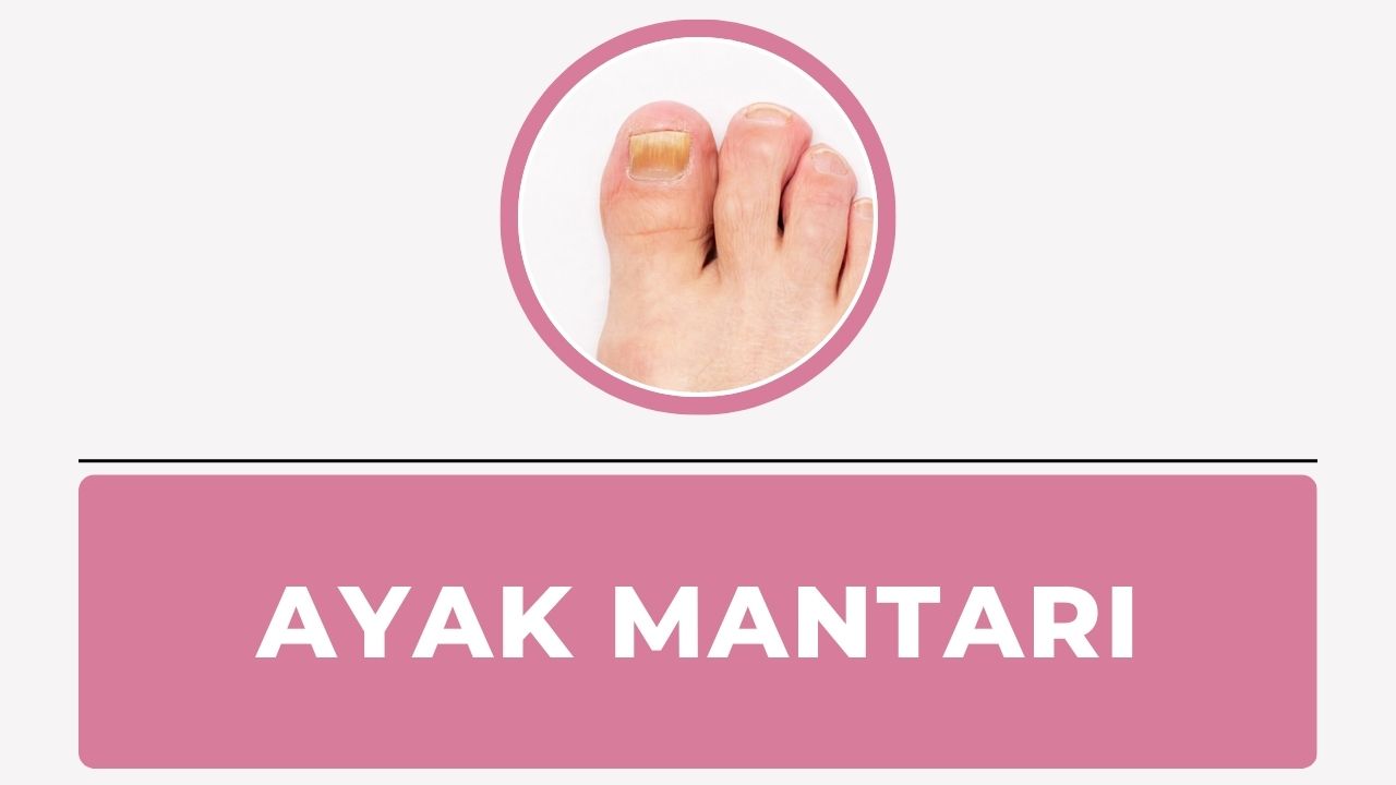 Ayak mantarı