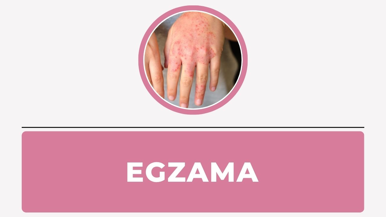 Egzama