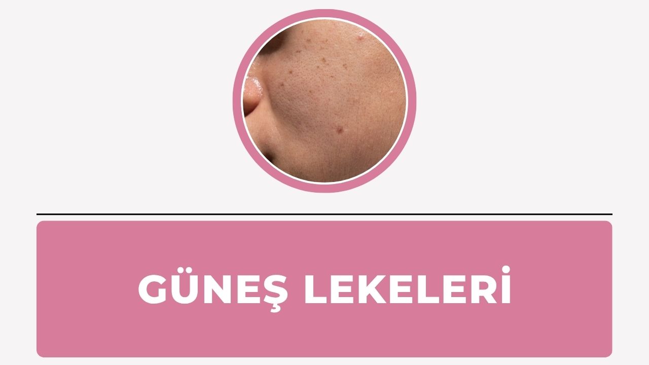Güneş lekeleri