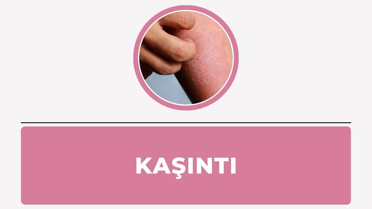 Kaşıntı