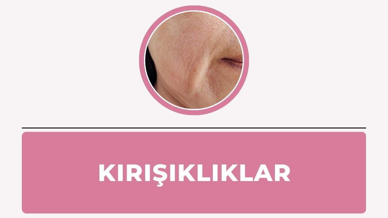 Kırışıklıklar