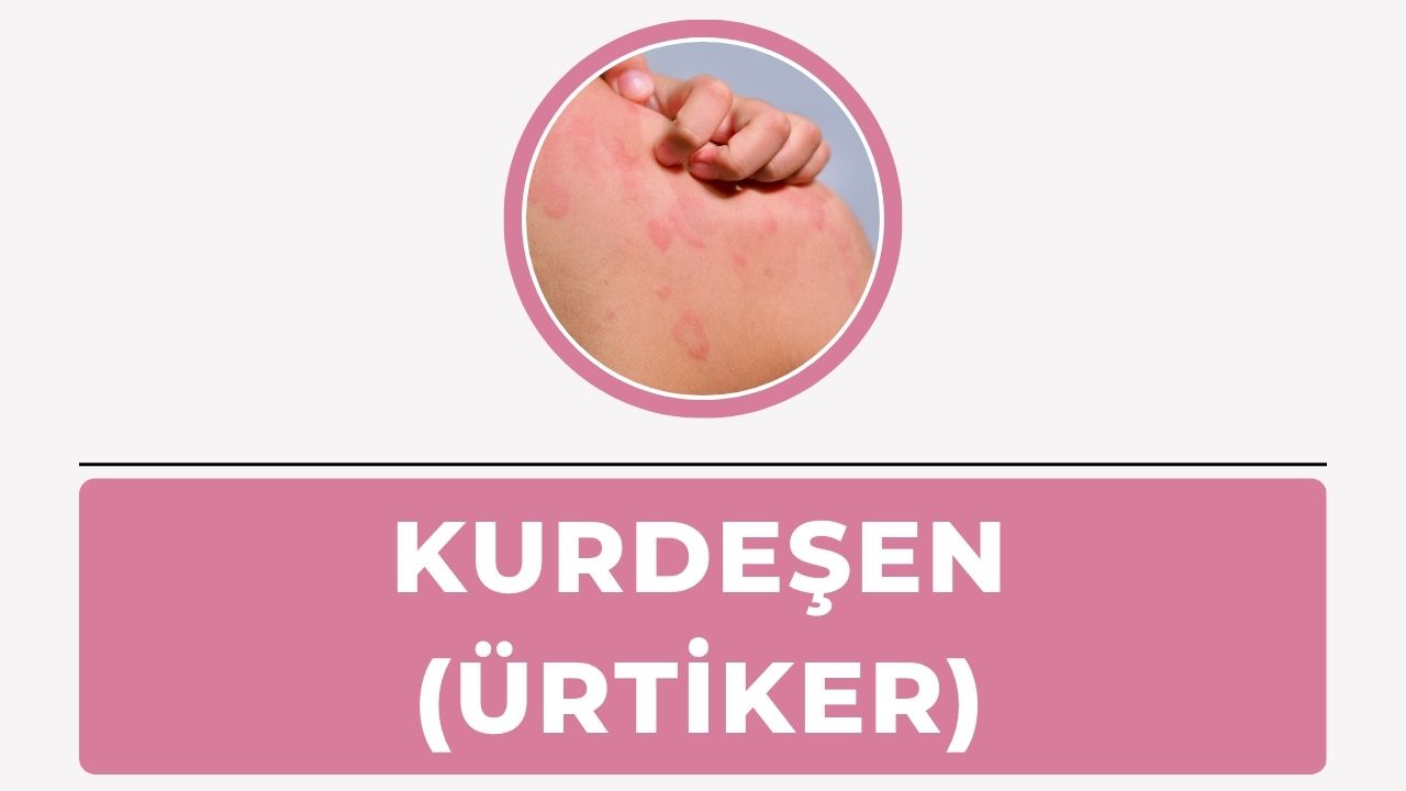 Kurdeşen
