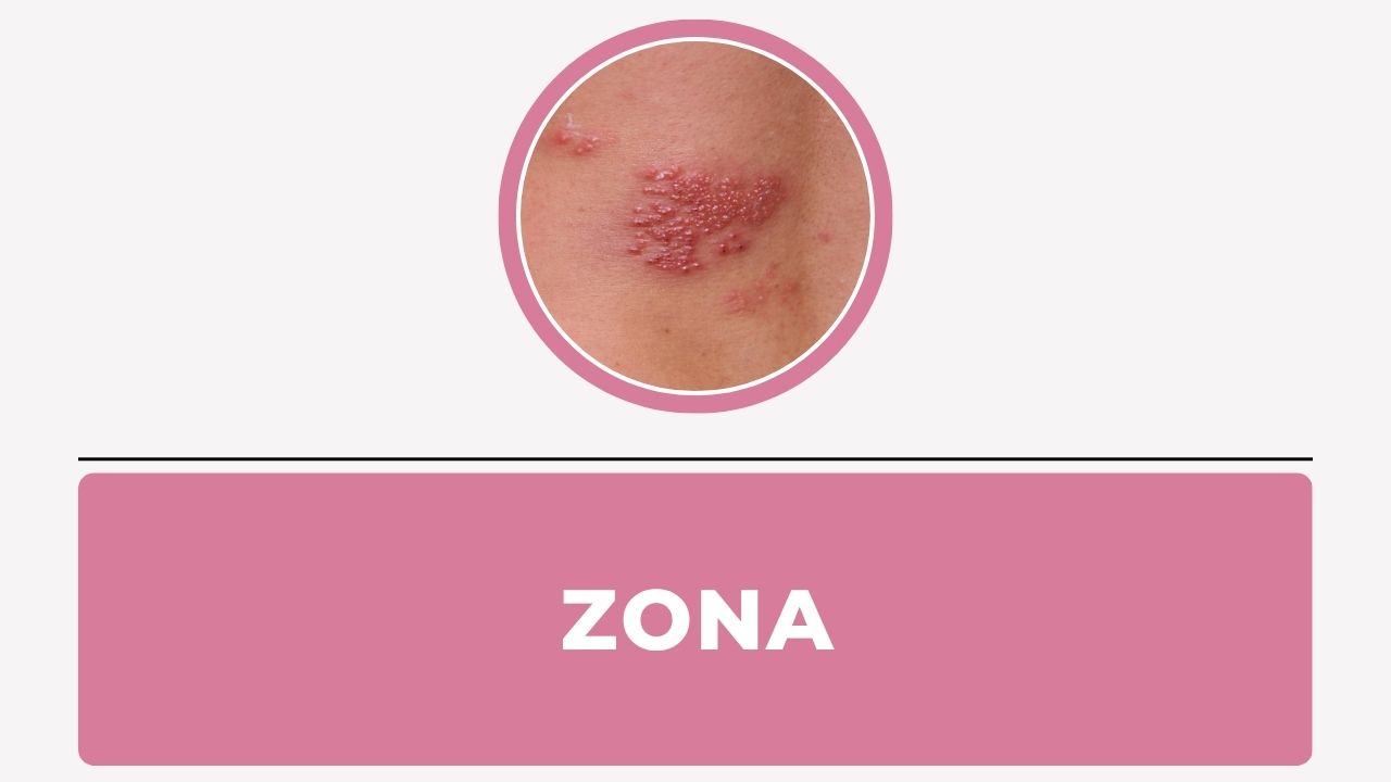 Zona
