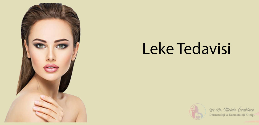 leke tedavisi